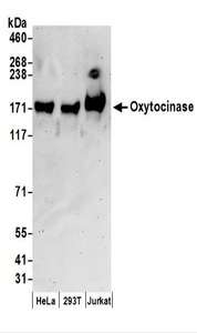 Detection of Human Oxytocinase by Western Blot. Samples: Whole cell lysate (50 ug) prepared using NETN buffer from HeLa, 293T, and Jurkat cells. Antibodies: Affinity purified rabbit anti-Oxytocinase antibody used for WB at 0.1 ug/ml. Detection: Chemiluminescence with an exposure time of 3 minutes.