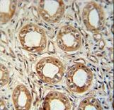LNPEP antibody immunohistochemistry of formalin-fixed and paraffin-embedded human kidney tissue followed by peroxidase-conjugated secondary antibody and DAB staining.
