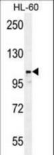 LNPEP Antibody western blot of HL-60 cell line lysates (35 ug/lane). The LNPEP antibody detected the LNPEP protein (arrow).
