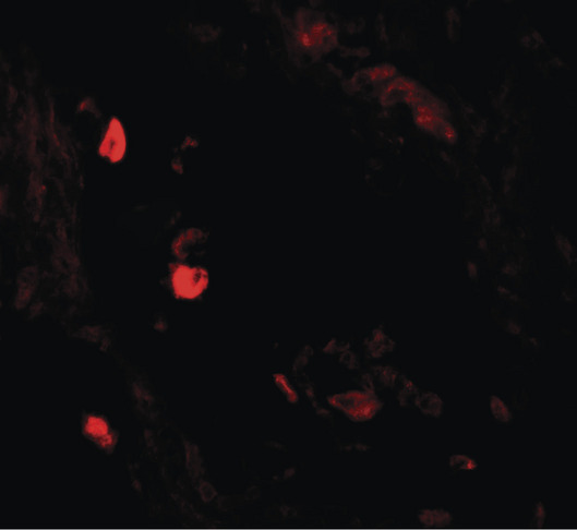 Immunofluorescence of LNPEP in human lung tissue with LNPEP antibody at 20 ug/ml.