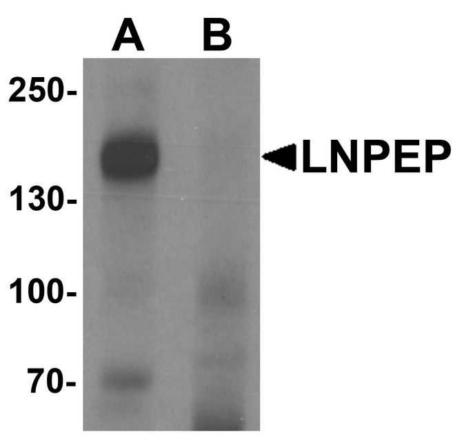 Western blot analysis of LNPEP in human lung tissue lysate with LNPEP antibody at 1 ug/ml in (A) the absence and (B) the presence of blocking peptide.