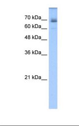 Transfected 293T cell lysate. Antibody concentration: 1.25 ug/ml. Gel concentration: 12%.
