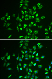 Immunofluorescence analysis of U2OS cell using LNX1 antibody. Blue: DAPI for nuclear staining.