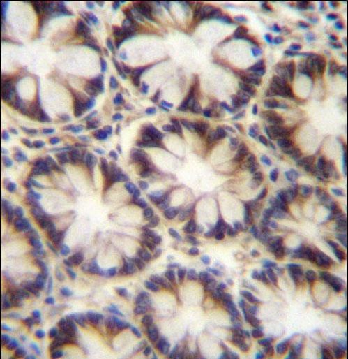 LNX2 Antibody immunohistochemistry of formalin-fixed and paraffin-embedded human rectum tissue followed by peroxidase-conjugated secondary antibody and DAB staining.