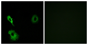 Immunofluorescence of A549 cells, using GRM7 Antibody. The picture on the right is treated with the synthesized peptide.