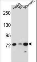 LNX2 Antibody western blot of HepG2,293,NCI-H460 cell line lysates (35 ug/lane). The LNX2 antibody detected the LNX2 protein (arrow).