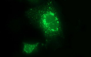 Anti-LOH12CR1 mouse monoclonal antibody immunofluorescent staining of COS7 cells transiently transfected by pCMV6-ENTRY LOH12CR1.
