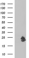 HEK293T cells were transfected with the pCMV6-ENTRY control (Left lane) or pCMV6-ENTRY LOH12CR1 (Right lane) cDNA for 48 hrs and lysed. Equivalent amounts of cell lysates (5 ug per lane) were separated by SDS-PAGE and immunoblotted with anti-LOH12CR1.