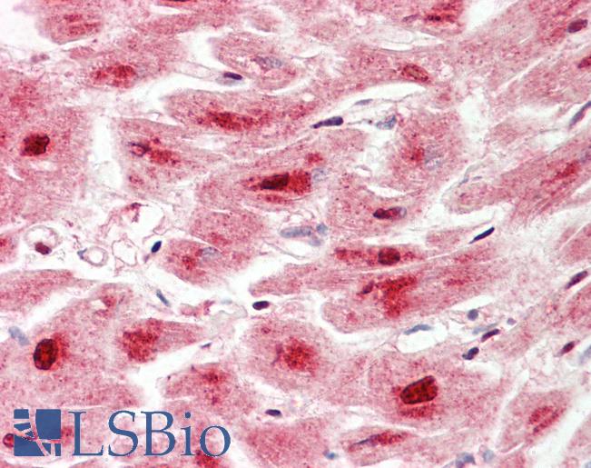 Anti-LONP1 / LON antibody IHC staining of human heart. Immunohistochemistry of formalin-fixed, paraffin-embedded tissue after heat-induced antigen retrieval. Antibody LS-B10032 dilution 1:100.