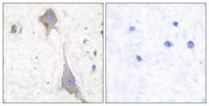 IHC of paraffin-embedded human brain tissue, using mGluR7 Antibody. The picture on the right is treated with the synthesized peptide.