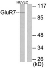 Western blot of extracts from HUVEC cells, using mGluR7 Antibody. The lane on the right is treated with the synthesized peptide.