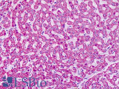Anti-GRM7 / MGLUR7 antibody IHC of human liver. Immunohistochemistry of formalin-fixed, paraffin-embedded tissue after heat-induced antigen retrieval. Antibody LS-A917 dilution 7 ug/ml.