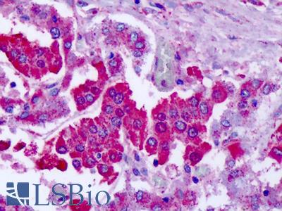 Anti-GRM7 / MGLUR7 antibody IHC of human adrenal. Immunohistochemistry of formalin-fixed, paraffin-embedded tissue after heat-induced antigen retrieval. Antibody LS-A917 dilution 7 ug/ml.