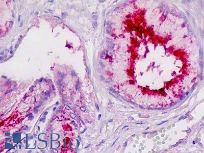 Anti-LP-PLA2 / PLA2G7 antibody IHC staining of human pancreatic duct. Immunohistochemistry of formalin-fixed, paraffin-embedded tissue after heat-induced antigen retrieval.