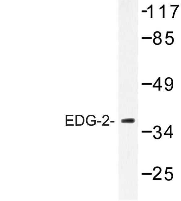 Western blot of EDG-2 (W45) pAb in extracts from Jurkat cells.