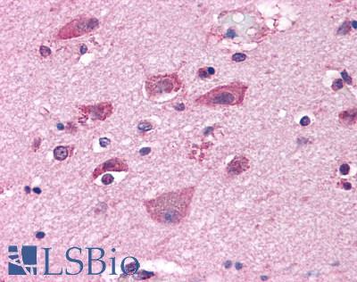 Anti-GRM7 / MGLUR7 antibody LS-A921 IHC of human brain, neurons and glia. Immunohistochemistry of formalin-fixed, paraffin-embedded tissue after heat-induced antigen retrieval.