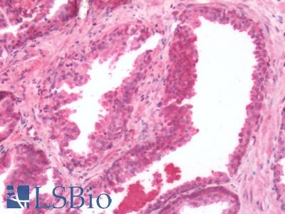 Human Prostate: Formalin-Fixed, Paraffin-Embedded (FFPE)