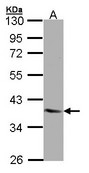 Sample (30 ug of whole cell lysate). A: A431. 10% SDS PAGE. LPAR3 antibody diluted at 1:1000.