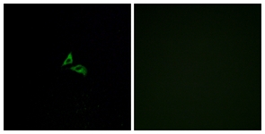 Immunofluorescence of A549 cells, using EDG7 Antibody. The picture on the right is treated with the synthesized peptide.