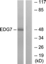 Western blot of extracts from Jurkat cells, using EDG7 Antibody. The lane on the right is treated with the synthesized peptide.