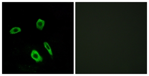 Immunofluorescence of LOVO cells, using EDG7 Antibody. The picture on the right is treated with the synthesized peptide.