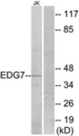 Western blot of extracts from Jurkat cells, using EDG7 Antibody. The lane on the right is treated with the synthesized peptide.