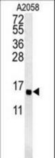 GOT1A Antibody western blot of A2058 cell line lysates (15 ug/lane). The GOT1A antibody detected the GOT1A protein (arrow).