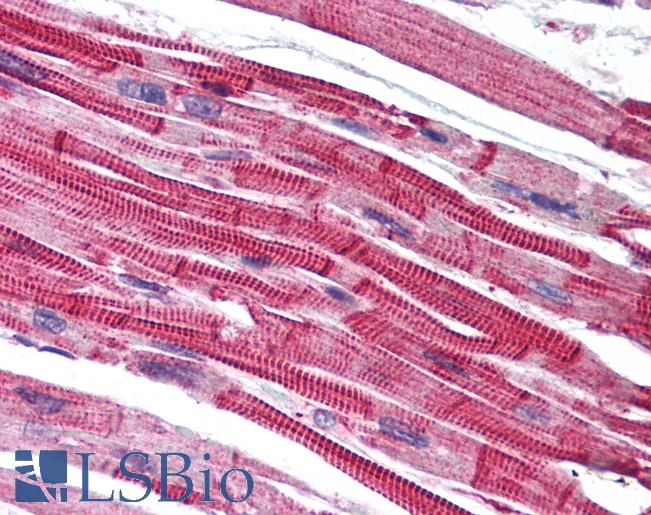 Anti-EDG7 antibody IHC of human heart. Immunohistochemistry of formalin-fixed, paraffin-embedded tissue after heat-induced antigen retrieval. Antibody LS-B1594 concentration 5 ug/ml.