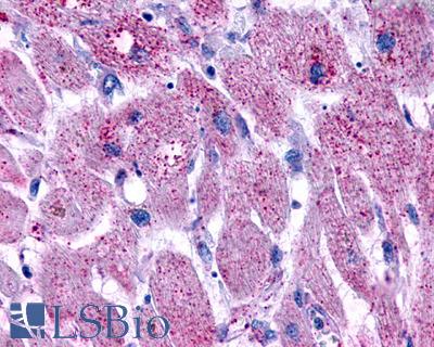 Anti-LPAR3 / LPA3 / EDG7 antibody IHC of human heart, myocardial infarct. Immunohistochemistry of formalin-fixed, paraffin-embedded tissue after heat-induced antigen retrieval.