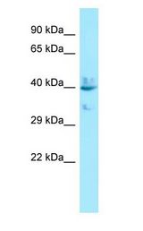 LPAR4 / GPR23 antibody Western Blot of 293T.