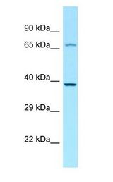 LPAR4 / GPR23 antibody Western Blot of RPMI-8226.