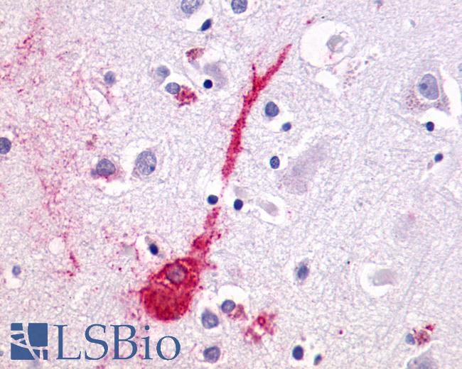 Anti-LPAR4 / GPR23 antibody IHC of human brain neuron. Immunohistochemistry of formalin-fixed, paraffin-embedded tissue after heat-induced antigen retrieval.