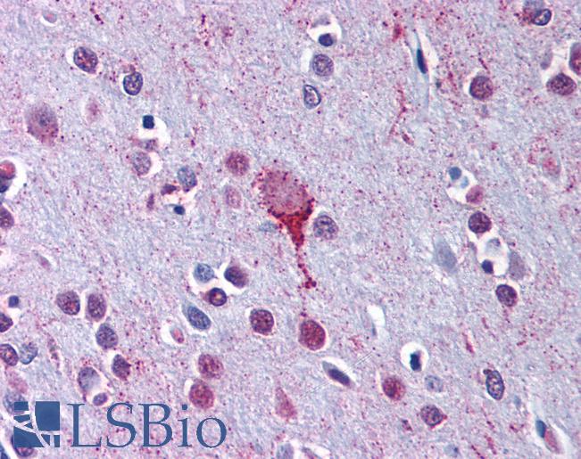 Anti-LPAR4 / GPR23 antibody LS-A872 IHC of human brain, cortex. Immunohistochemistry of formalin-fixed, paraffin-embedded tissue after heat-induced antigen retrieval.