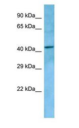 LPAR5 / GPR92 antibody Western Blot of HeLa cell lysate.