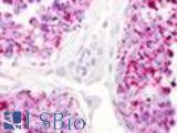 Anti-LPAR5 / GPR92 antibody LS-A426 IHC of human testis. Immunohistochemistry of formalin-fixed, paraffin-embedded tissue after heat-induced antigen retrieval.