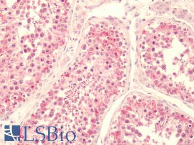 Human, Testis: Formalin-Fixed Paraffin-Embedded (FFPE)