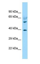 LPAR6 / P2RY5 / P2Y5 antibody Western Blot of Fetal Heart.