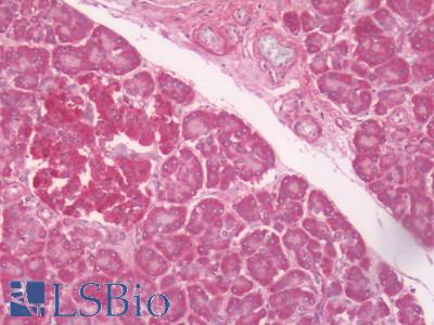 Human Pancreas: Formalin-Fixed, Paraffin-Embedded (FFPE)