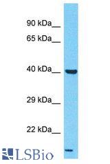 LPAR6 / P2RY5 / P2Y5 antibody Western Blot of HeLa. Antibody dilution: 1 ug/ml.