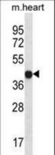 LPAR6 Antibody western blot of mouse heart tissue lysates (35 ug/lane). The LPAR6 antibody detected the LPAR6 protein (arrow).