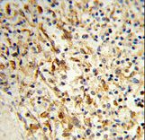 Formalin-fixed and paraffin-embedded human spleen tissue reacted with PCAT1 Antibody , which was peroxidase-conjugated to the secondary antibody, followed by DAB staining. This data demonstrates the use of this antibody for immunohistochemistry; clinical relevance has not been evaluated.