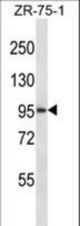 GRM8 Antibody western blot of ZR-75-1 cell line lysates (35 ug/lane). The GRM8 antibody detected the GRM8 protein (arrow).