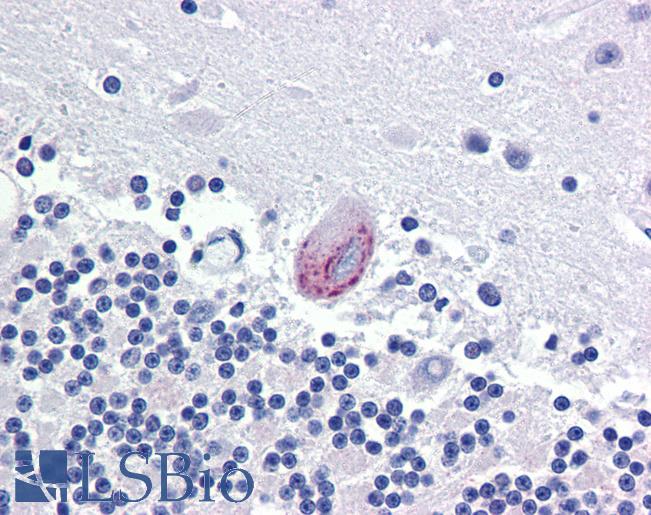 Anti-LPCAT1 antibody LS-A9903 IHC of human brain, cerebellum. Immunohistochemistry of formalin-fixed, paraffin-embedded tissue after heat-induced antigen retrieval.