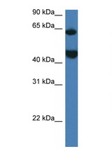 LPCAT2 antibody LS-C145270 Western blot of Mouse Thymus lysate. Antibody concentration 1 ug/ml.