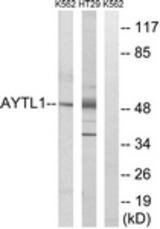 Western blot of extracts from K562/HT-29 cells, using LPCAT2 Antibody. The lane on the right is treated with the synthesized peptide.