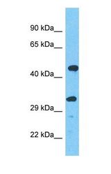 Western blot of LPGAT1 Antibody with human A549 Whole Cell lysate.