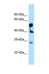 LPGAT1 antibody LS-C146011 Western blot of Fetal Liver lysate. Antibody concentration 1 ug/ml.
