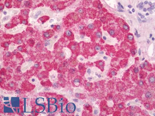 Human Liver: Formalin-Fixed, Paraffin-Embedded (FFPE)