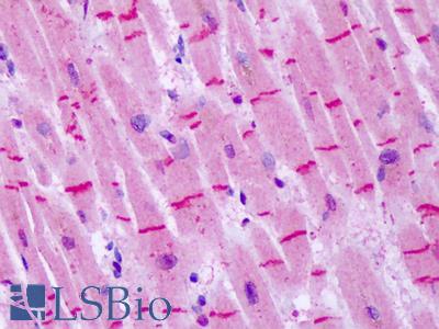 Anti-GRM8 / MGLUR8 antibody IHC of human heart. Immunohistochemistry of formalin-fixed, paraffin-embedded tissue after heat-induced antigen retrieval. Antibody LS-A922 dilution 6 ug/ml.