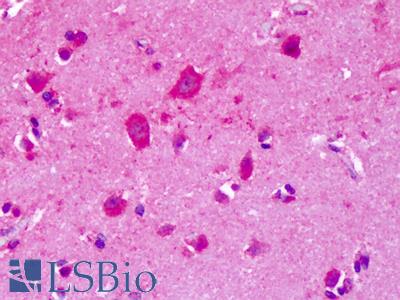 Anti-GRM8 / MGLUR8 antibody IHC of human brain, cortex. Immunohistochemistry of formalin-fixed, paraffin-embedded tissue after heat-induced antigen retrieval. Antibody LS-A922 dilution 6 ug/ml.